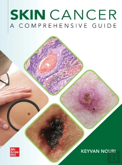 Bertrand.pt - Skin Cancer: A Comprehensive Guide