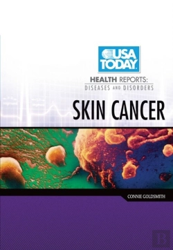 Bertrand.pt - Skin Cancer