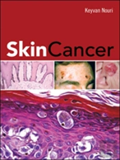 SKIN CANCER