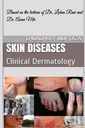 Skin Diseases