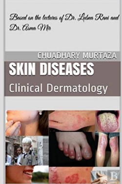 Bertrand.pt - Skin Diseases