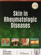 Skin In Rheumatologic Diseases