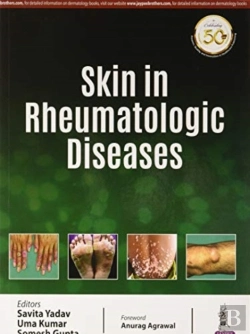 Bertrand.pt - Skin In Rheumatologic Diseases