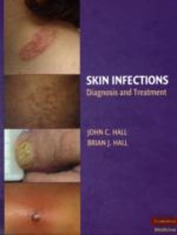 Bertrand.pt - Skin Infections