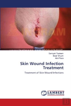 Bertrand.pt - Skin Wound Infection Treatment