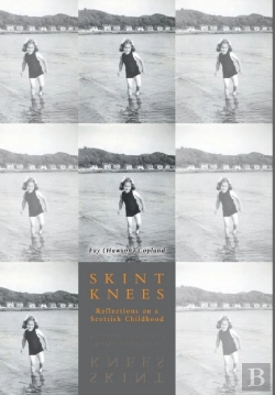 Bertrand.pt - Skint Knees