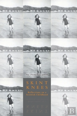 Bertrand.pt - Skint Knees
