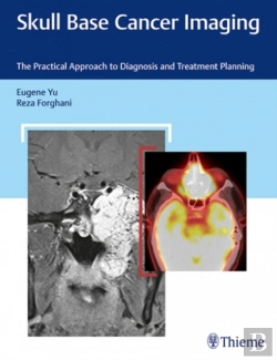 Bertrand.pt - Skull Base Cancer Imaging