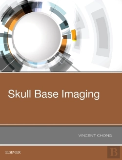 Bertrand.pt - Skull Base Imaging