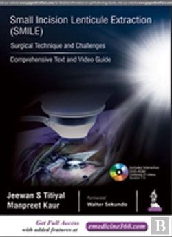 Bertrand.pt - Small Incision Lenticule Extraction (Smile): Surgical Technique And Challenges