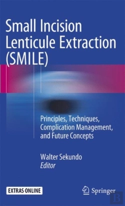Bertrand.pt - Small Incision Lenticule Extraction (Smile)