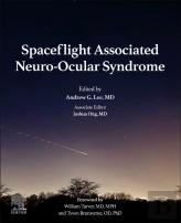 Spaceflight Associated Neuro-Ocular Syndrome
