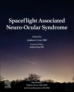 Bertrand.pt - Spaceflight Associated Neuro-Ocular Syndrome