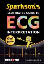 Sparkson'S Illustrated Guide To Ecg Interpretation, 2nd Edition