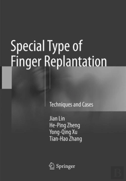 Bertrand.pt - Special Type Of Finger Replantation