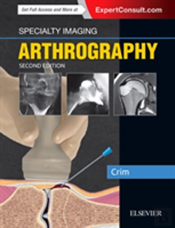 Bertrand.pt - Specialty Imaging: Arthrography