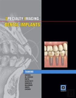 Bertrand.pt - Specialty Imaging: Dental Implants