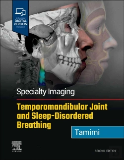Bertrand.pt - Specialty Imaging: Temporomandibular Joint And Sleep-Disordered Breathing