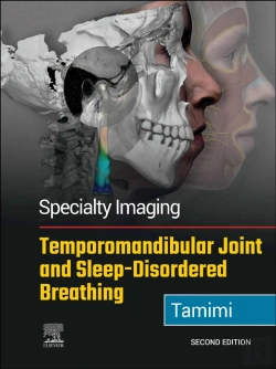 Bertrand.pt - Specialty Imaging: Temporomandibular Joint And Sleep-Disordered Breathing E-Book