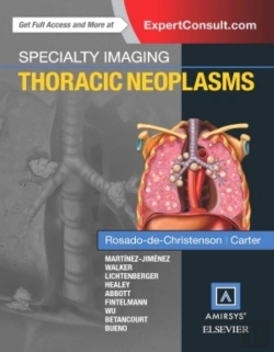 Bertrand.pt - Specialty Imaging: Thoracic Neoplasms