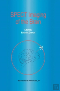 Bertrand.pt - Spect Imaging Of The Brain