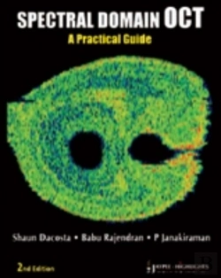 Bertrand.pt - Spectral Domain Oct