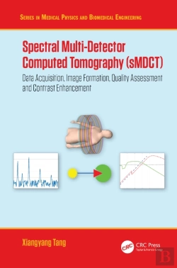 Bertrand.pt - Spectral Multi-Detector Computed Tomography (Smdct)