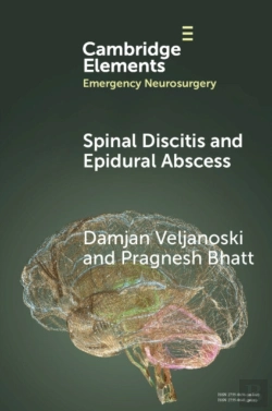 Bertrand.pt - Spinal Discitis And Epidural Abscess