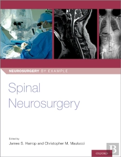 Bertrand.pt - Spinal Neurosurgery