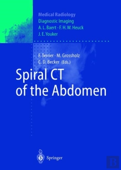 Bertrand.pt - Spiral Ct Of The Abdomen