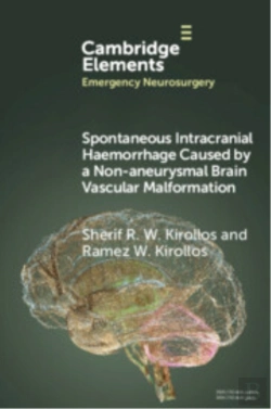 Bertrand.pt - Spontaneous Intracranial Haemorrhage Caused By A Non-Aneurysmal Brain Vascular Malformation