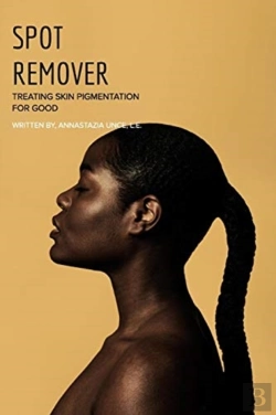 Bertrand.pt - Spot Remover