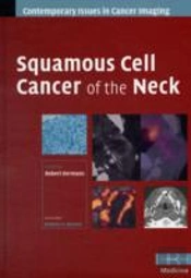 Squamous Cell Cancer Of The Neck