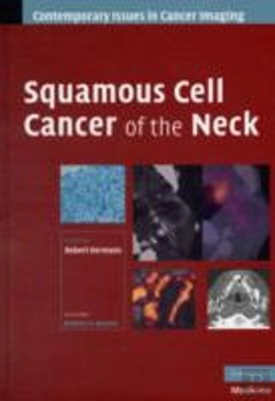 Bertrand.pt - Squamous Cell Cancer Of The Neck