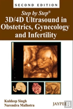 Bertrand.pt - Step By Step: 3d/4d Ultrasound In Obstetrics, Gynecology And Infertility