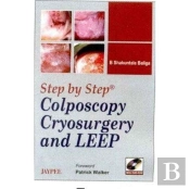 Step By Step Colposcopy Cryosur With Dv