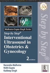 Step By Step Interventional Ultrasound In Obstetrics And Gynecology