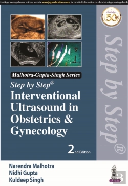 Bertrand.pt - Step By Step Interventional Ultrasound In Obstetrics And Gynecology