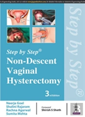 Step By Step: Non-Descent Vaginal Hysterectomy