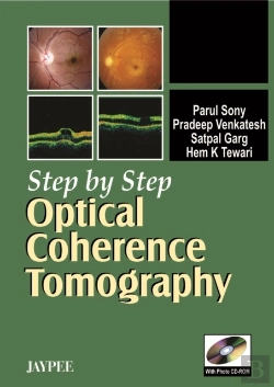 Bertrand.pt - Step By Step Optical Coherence Tomography