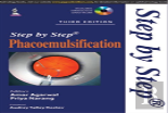 Step By Step Phacoemulsification