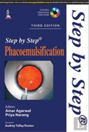 Step By Step Phacoemulsification