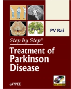 Bertrand.pt - Step By Step: Treatment Of Parkinson Disease
