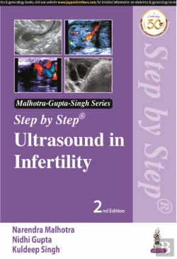Bertrand.pt - Step By Step Ultrasound In Infertility