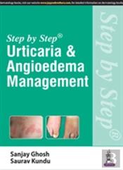 Step By Step: Urticaria & Angioedema Management