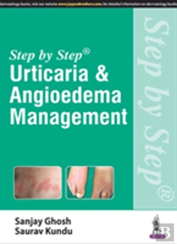 Bertrand.pt - Step By Step: Urticaria & Angioedema Management