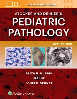 Bertrand.pt - Stocker And Dehner'S Pediatric Pathology