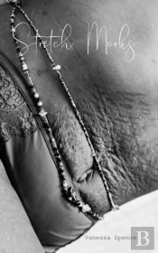 Stretch Marks