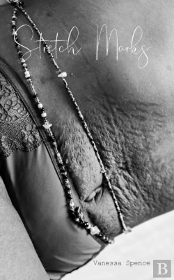Bertrand.pt - Stretch Marks