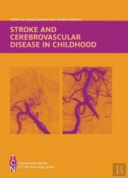 Bertrand.pt - Stroke And Cerebrovascular Disease In Childhood